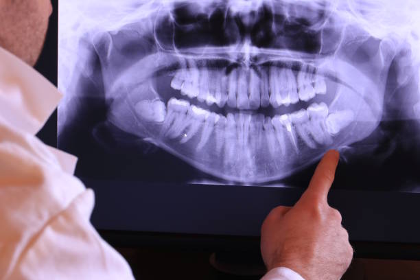 Best Cracked Tooth Emergency Dentist  in Manchester, OH