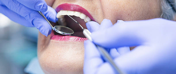 Best Dentist for Tooth Abscess  in Manchester, OH